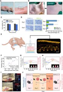 PolyU develops wearable microneedle patch to empower conventional ultrasound for continuous glucose monitoring
