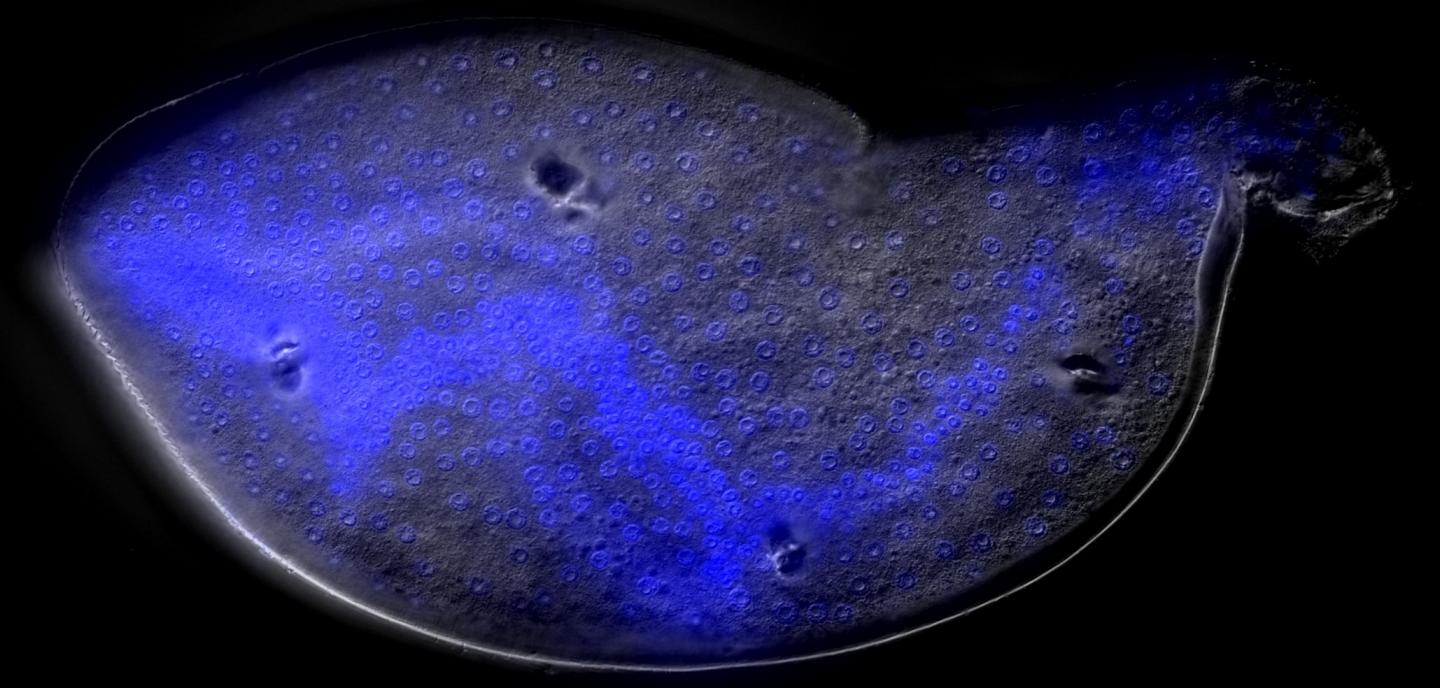 Female Soybean Cyst Nematode