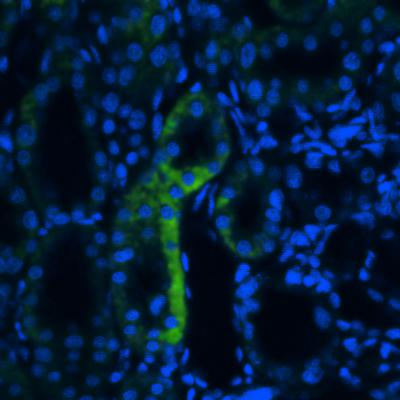 Renal Failure Treatment Cell Engraftment