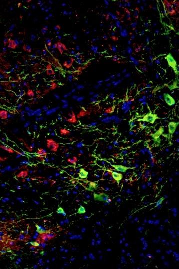 In Mice, Targeting Inflammation Linked to Parkinson's Disease Reduces Brain Cell Death (2 of 3)