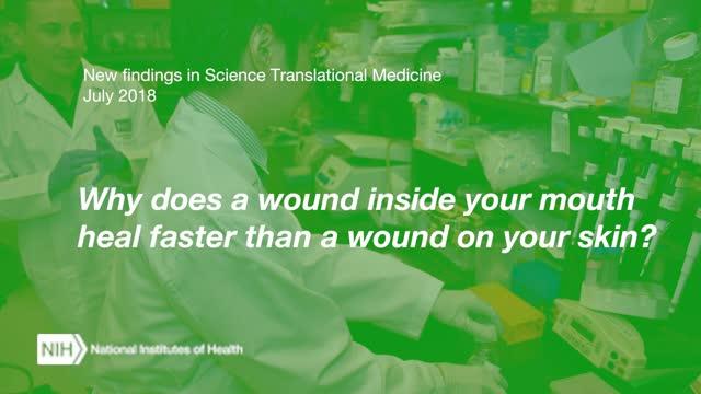 NIH Study Examines Processes Underlying Rapid Wound Healing in the Mouth