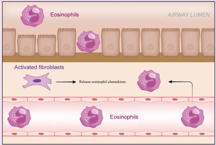 Tumor necrosis factor-α induces human bronchial fibroblasts to produce cytokines: implications for airway inflammation