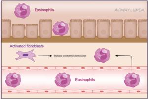 Tumor necrosis factor-α induces human bronchial fibroblasts to produce cytokines: implications for airway inflammation