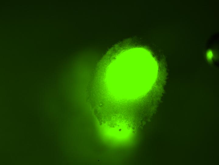 Strain of <i>E. coli</i>