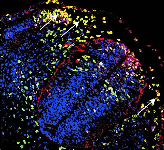 Increased Ribosome Biogenesis