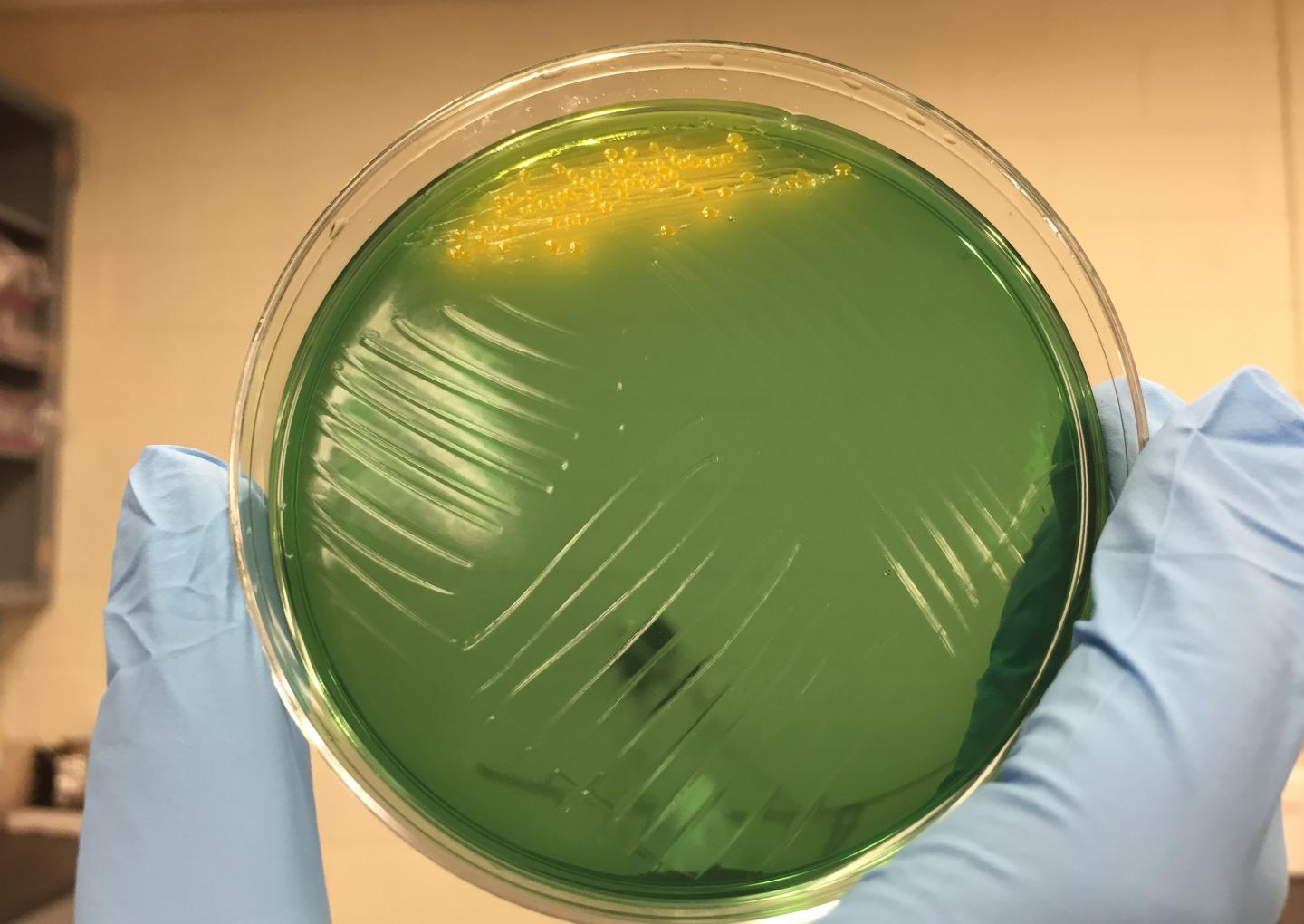 Cholera Colonies on Agar