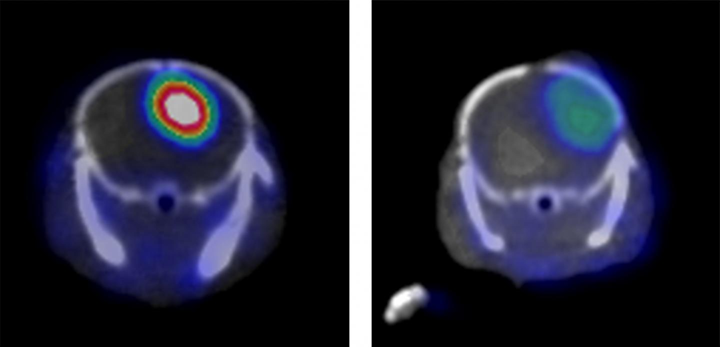 Cancer Detection