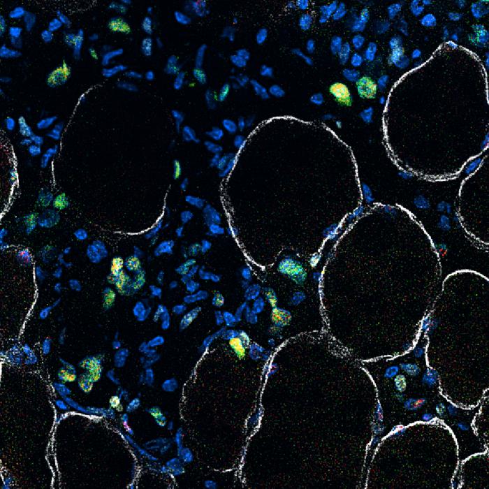 Muscle stem cells in action