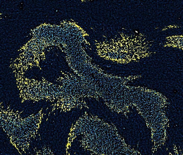 Anisotropic ferroptotic cell death waves