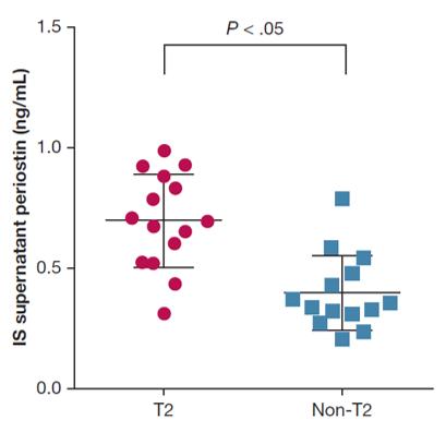 Protein Found in Patients with Severe Asthma Can Help Identify Who Would Benefit from Targeted Drugs