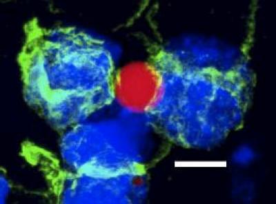Particles and activated T-Cells