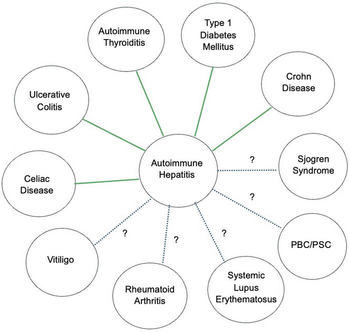 Autoimmune Hepatitis Associated with Other Autoimmune Diseases