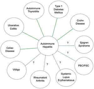 Autoimmune Hepatitis Associated with Other Autoimmune Diseases