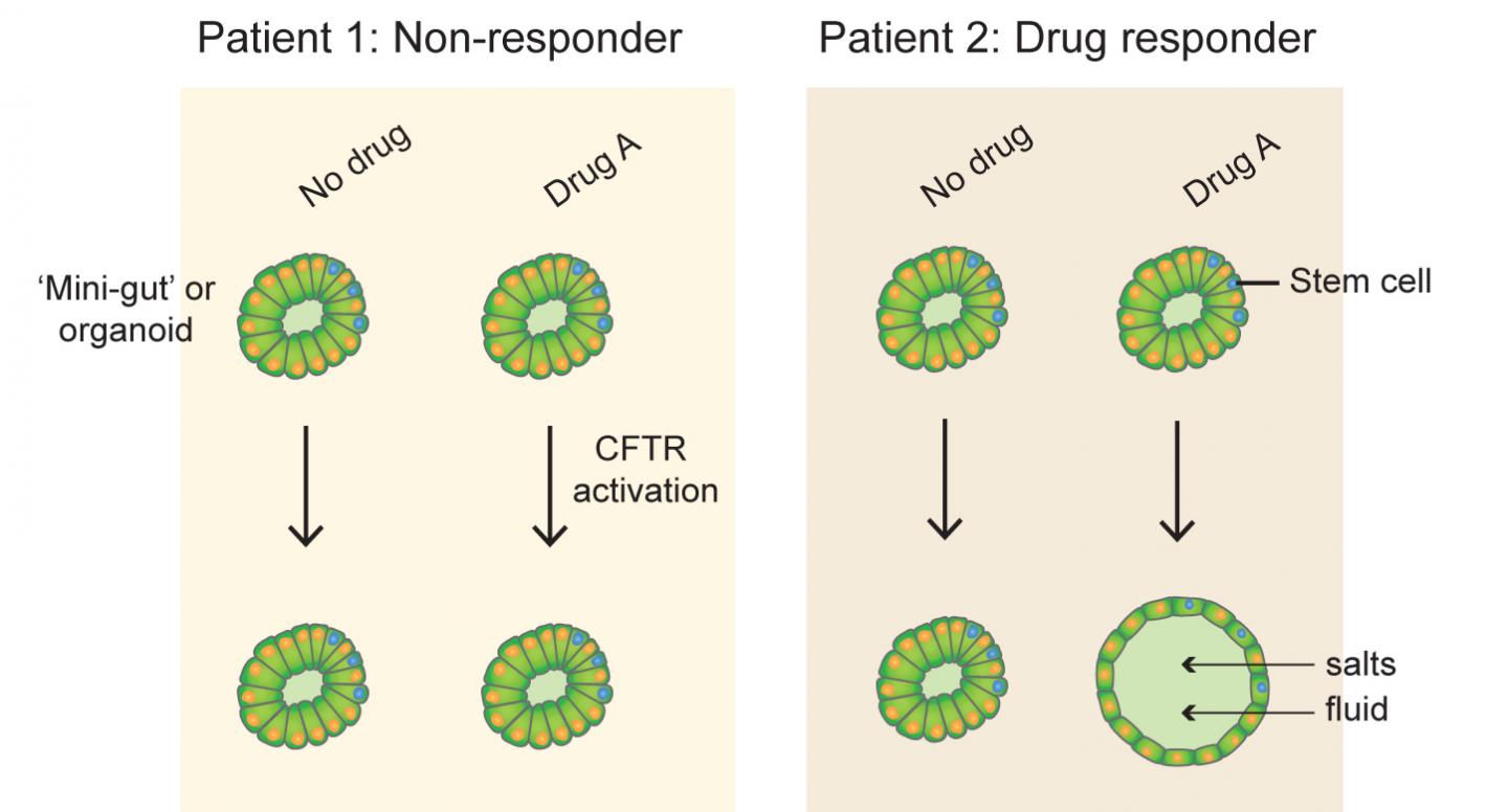 Mini-Guts Predict Cystic Fibrosis Patients' Response to Therapy (1 of 1)