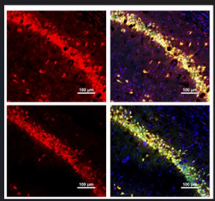 TXM-CB3 reduces oxidative damage