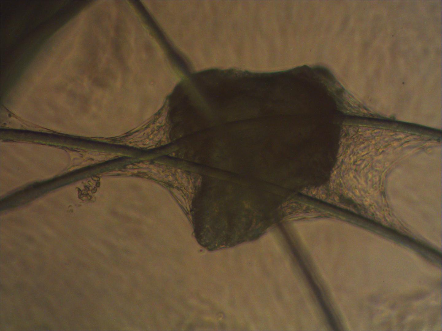 Human Bone Cells on a Scaffold