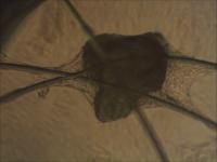 Human Bone Cells on a Scaffold