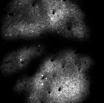 In Vivo Neural Imaging