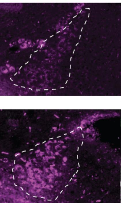 After a history of stress and drinking, the brain simply works differently.
