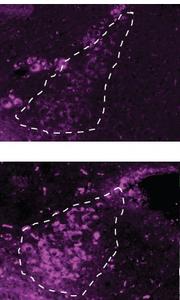 After a history of stress and drinking, the brain simply works differently.