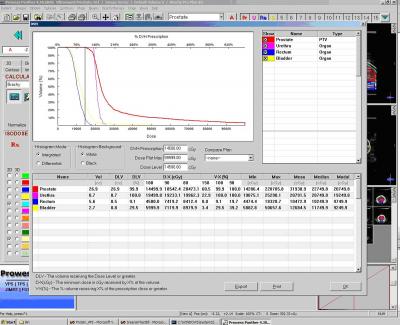 Dose-Volume Histogram