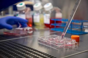 Lab work in the Centre for Cancer Immunology