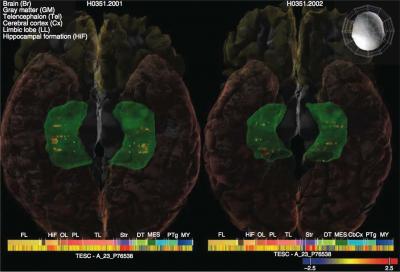 Bigger Memory Centers