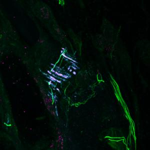 A new clue to how the body detects physical force