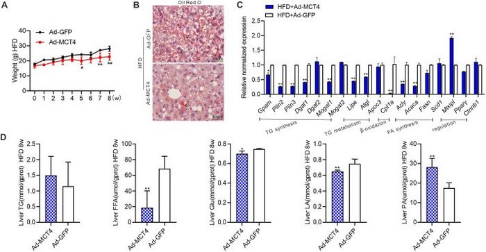 MCT4 inhibits the progress of NAFLD in vivo.