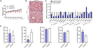 MCT4 inhibits the progress of NAFLD in vivo.