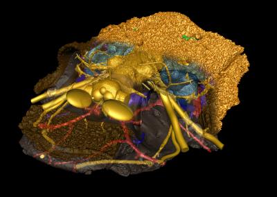 Computer Model of <i>Romundia</i> Scull