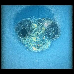 Human embryo compactation + invasion