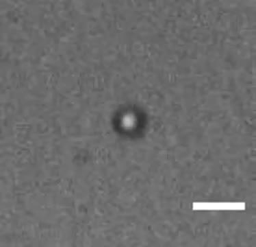 The UPMC Cam Captures a Microbubble in Action