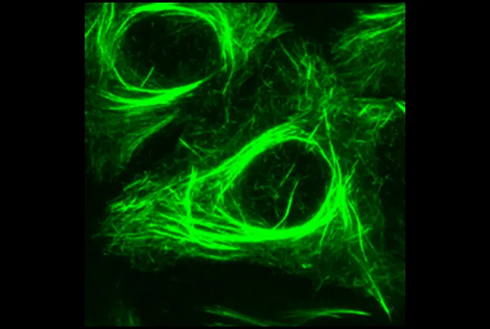 Study Identifies Gene Linked to Chemotherapy Resistance in Prostate Cancer