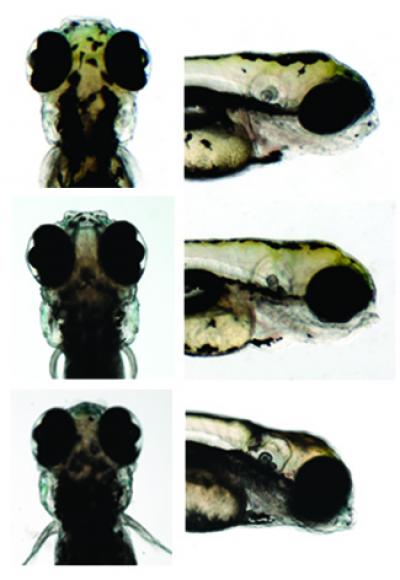 Genetics of Head Size