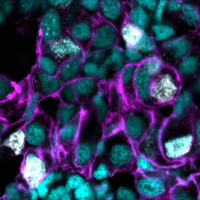 DNA damage in zebrafish liver tumour