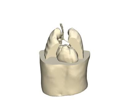 Video Digital Twin from a human heart