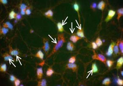 Cells Lacking the Protein Bcl-xL