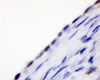 Healthy Ovarian Tissue