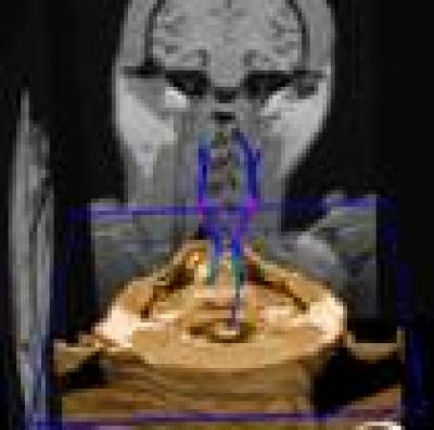 Corticospinal Tract