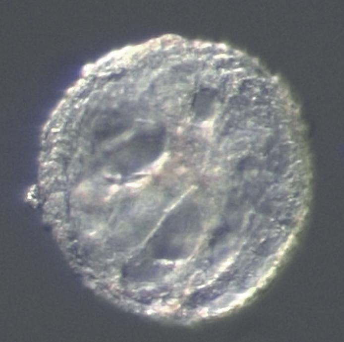 Pancreas Organoid