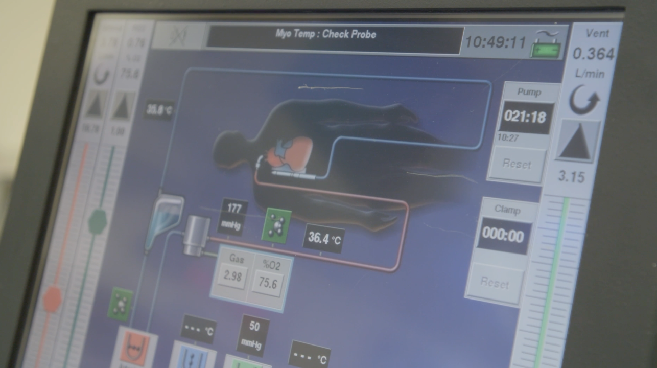 A monitoring screen that tracks blood flow, oxygen levels, and temperature.