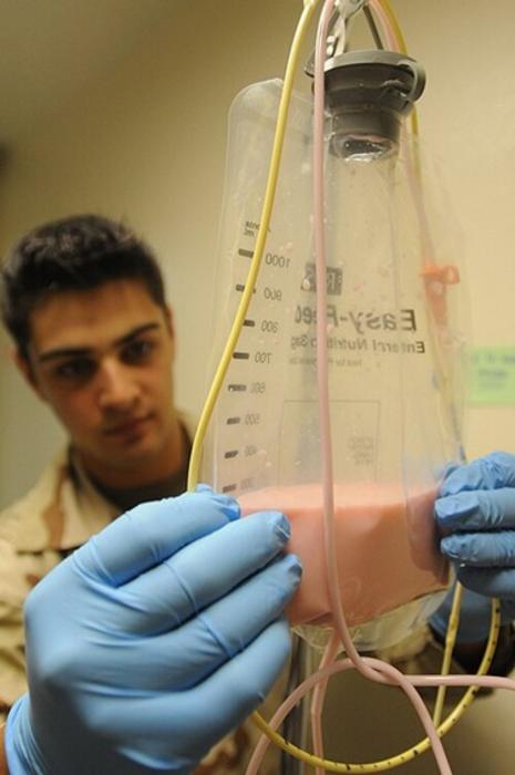 Enteral nutrition is associated with feeding intolerance in critically ill patients