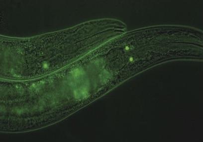 Key factor identified that makes worms feel full after a good meal