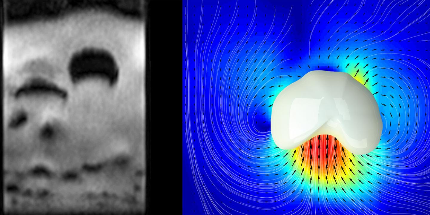Granular Media