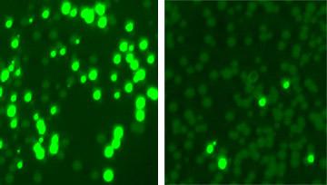 'Programmable' Antibiotic Harnesses An Enzyme to Attack Drug-Resistant Microbes
