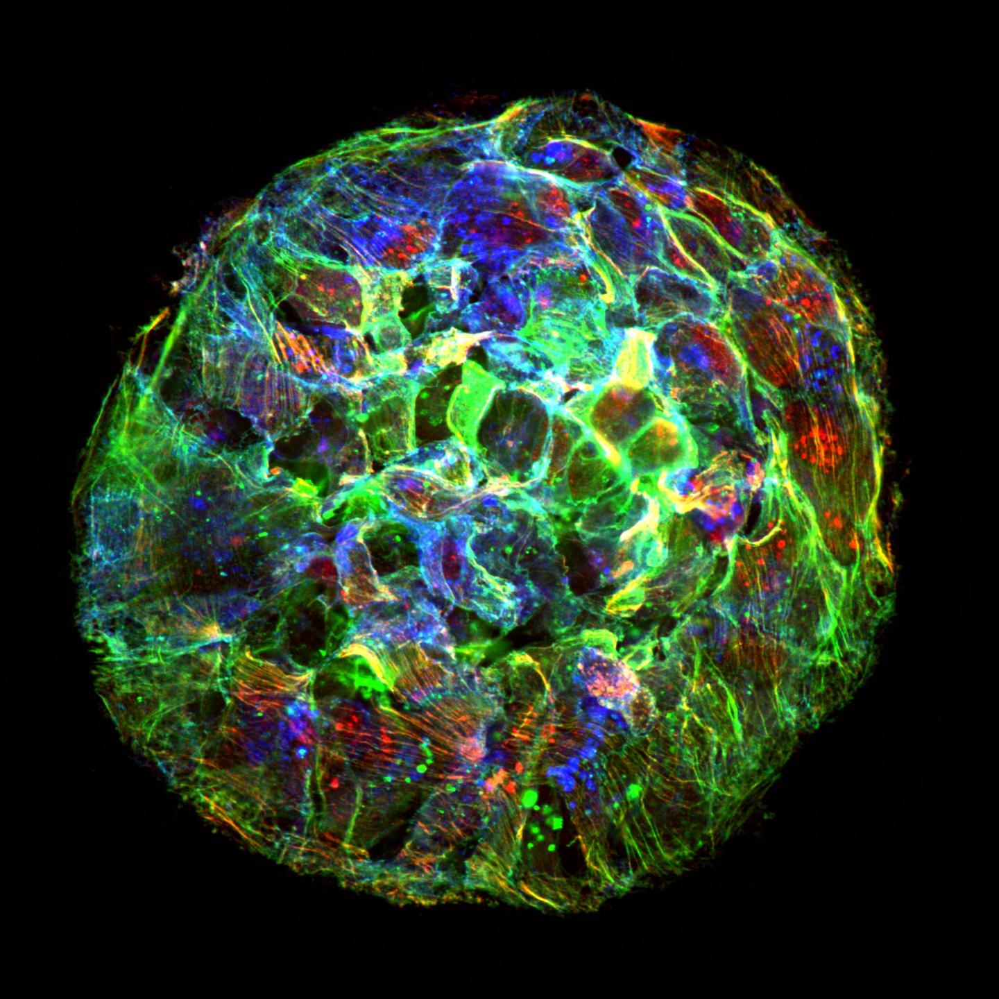 Tumor Cells