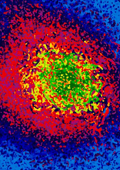 A Coherant X-ray Speckle Pattern