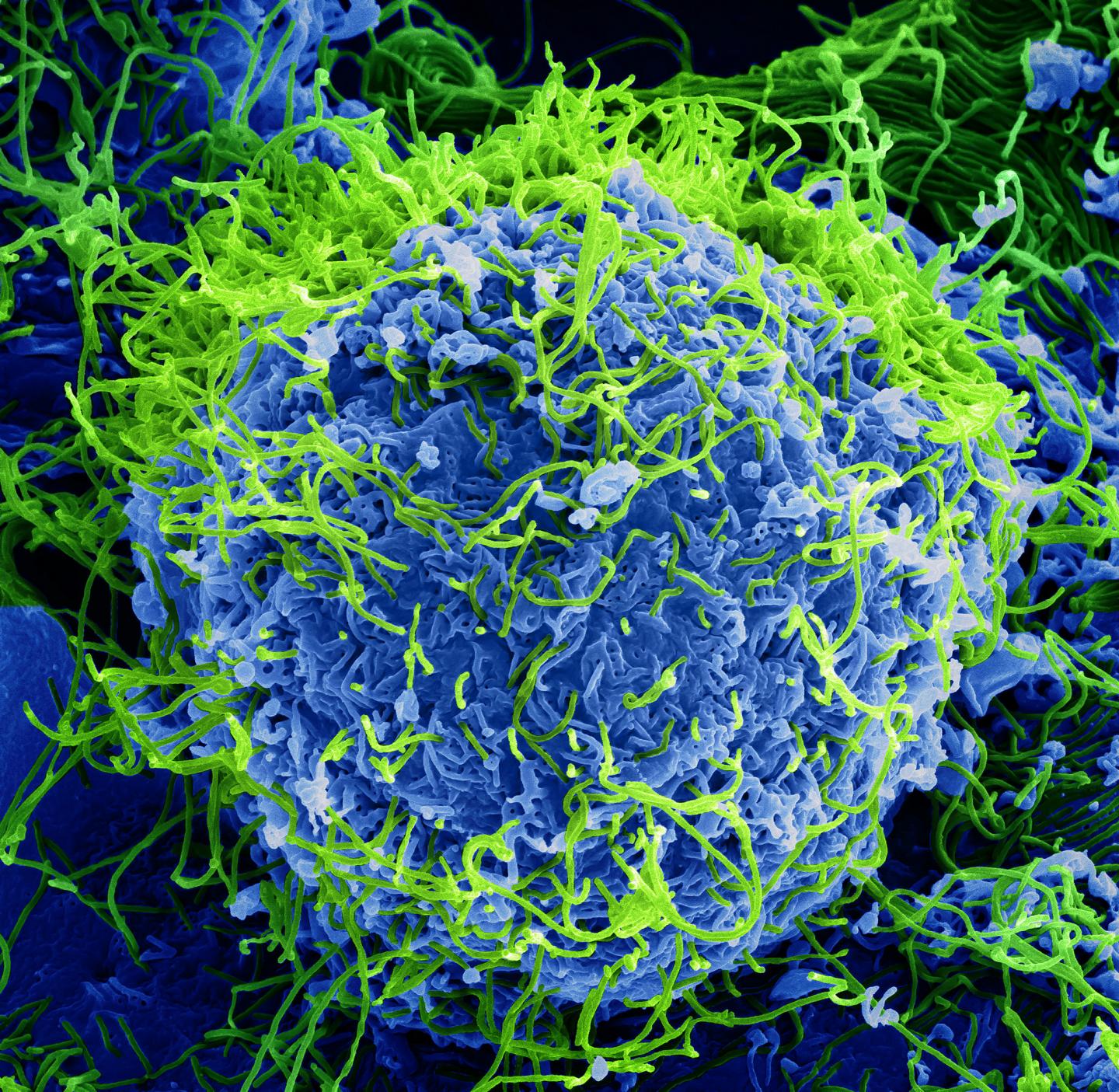Ebola