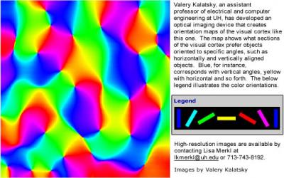 Brain Plasticity Measured at UH